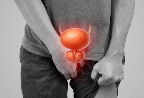 Prostate Cancer Burden Rising In Nigeria, Expert Warns