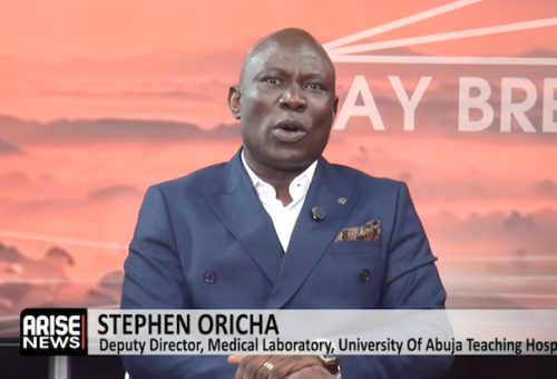 Nigeria Must Strengthen Ebola Preparedness Before An Outbreak – Arise News