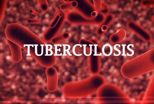 Plateau records 11,000 TB cases in 2026