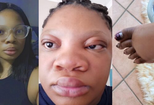 “Is she allergic to pregnancy?” – Lady’s pregnancy transformation stirs unease